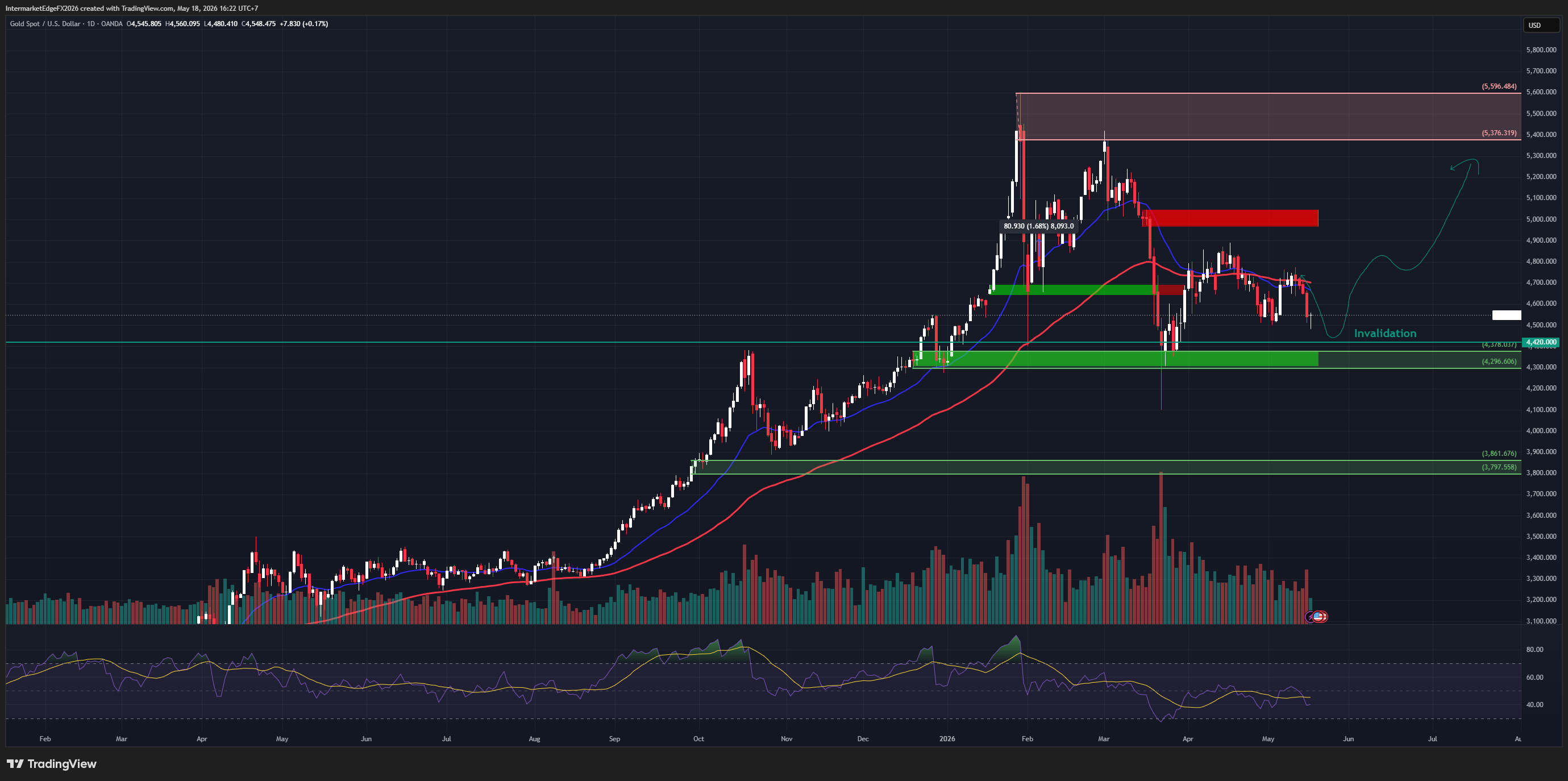 Gold at $4,553 - What Is the Market Still Pricing In?